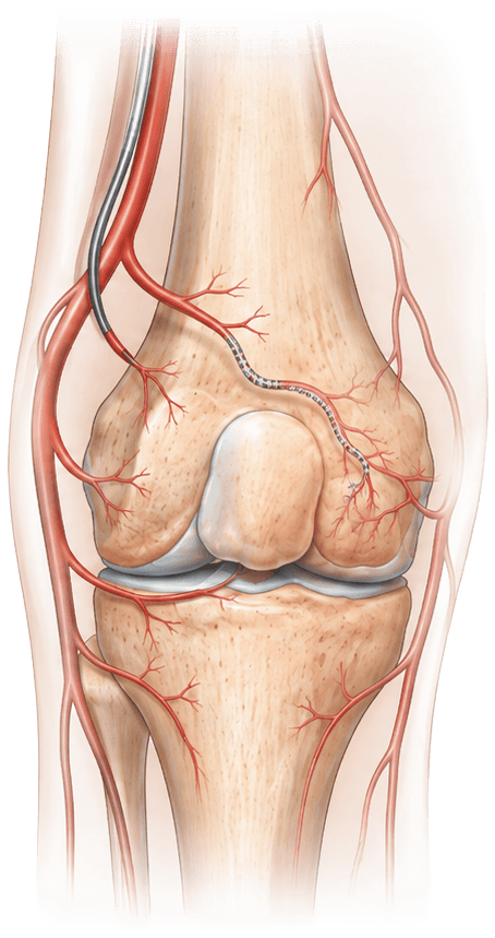 Calm the inflammation