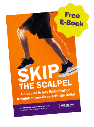 Cover of “Skip the Scalpel,” the free Empire Vein patient e-book on genicular artery embolization for knee arthritis