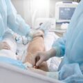 Vascular surgeons performing a vein ablation treatment.