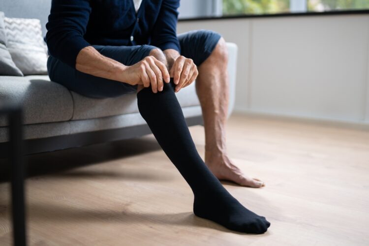 A man with varicose veins putting on a compression sock.